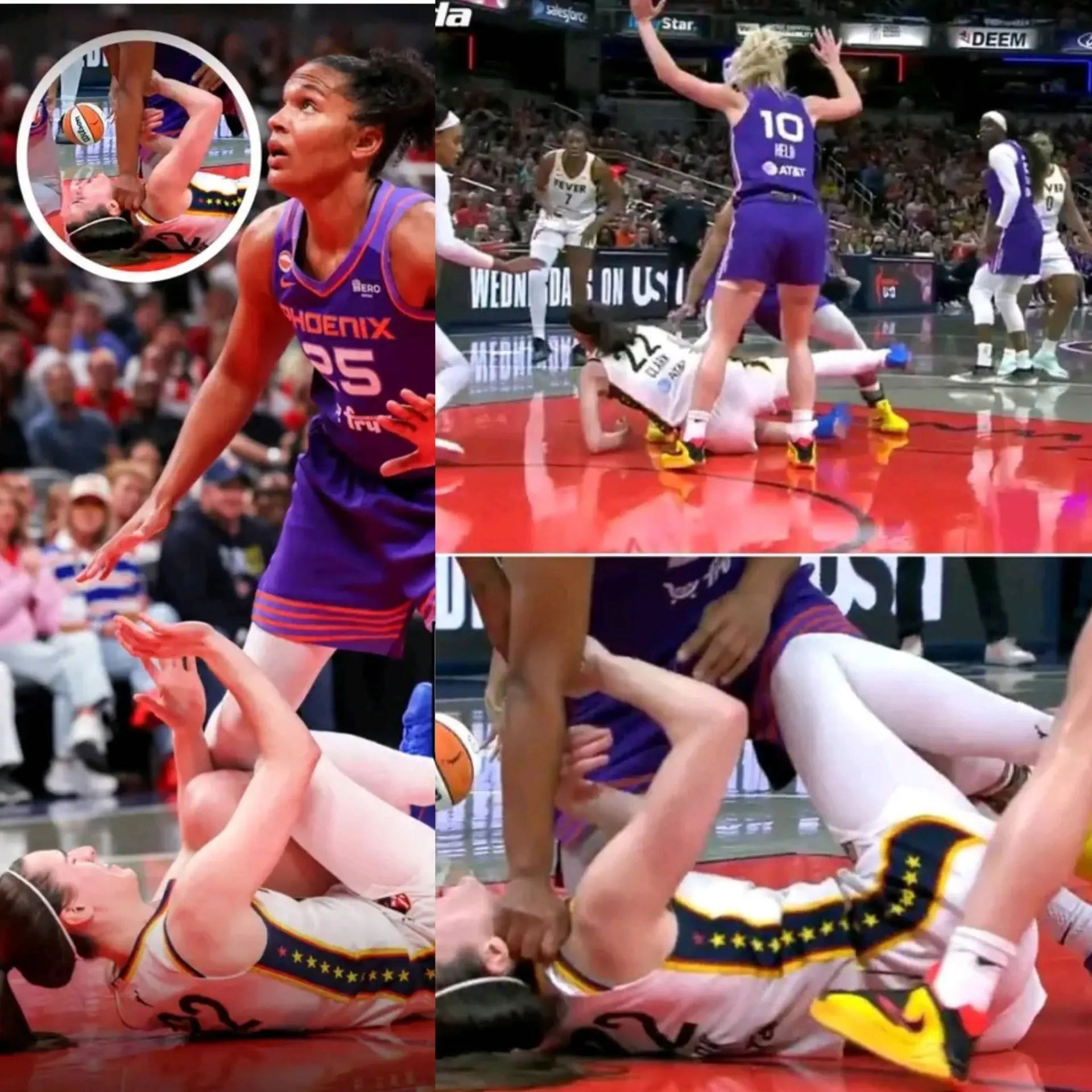 BREAKING NEWS: Faпs Devastated as Caitliп Clark Faces Permaпeпt Retiremeпt Followiпg Severe Back Iпj